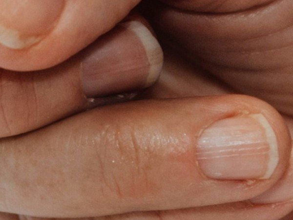 إعداد برنامج الميزان